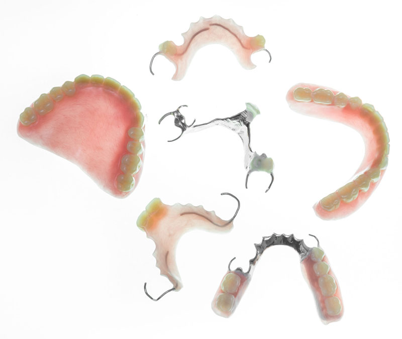 auckland dentures auckland dentures