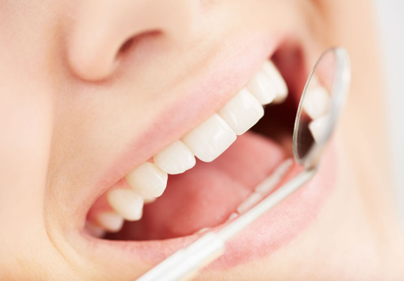 dental Check-Ups dental Check-Ups