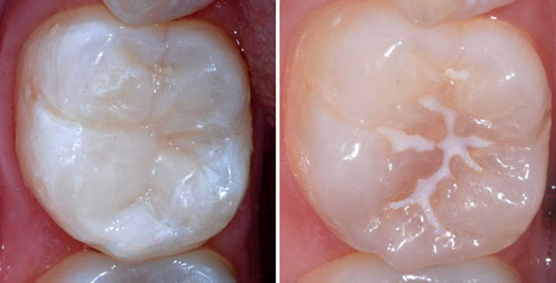 dental specialists auckland dental specialists auckland